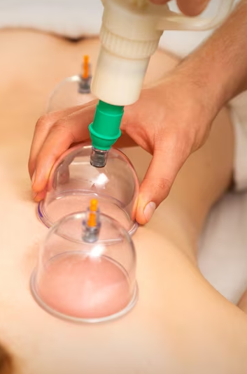 The Best Hijama Therapy Center in Yakhutpura, Hyderabad