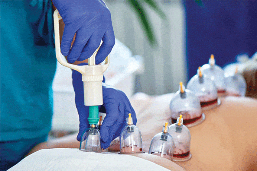 Best Hijama Centre in Bahadurpura, Hyderabad
